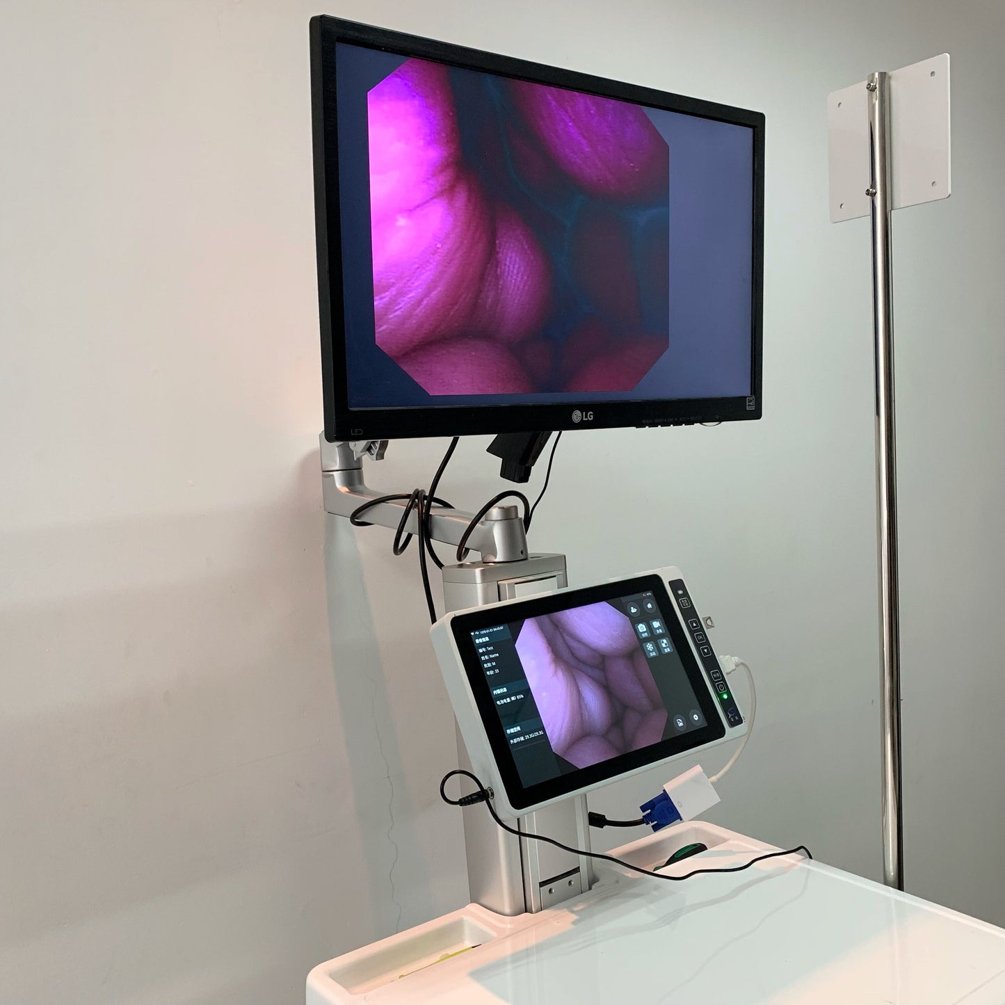 Disposable Flexible Video Ureteroscope Urological
